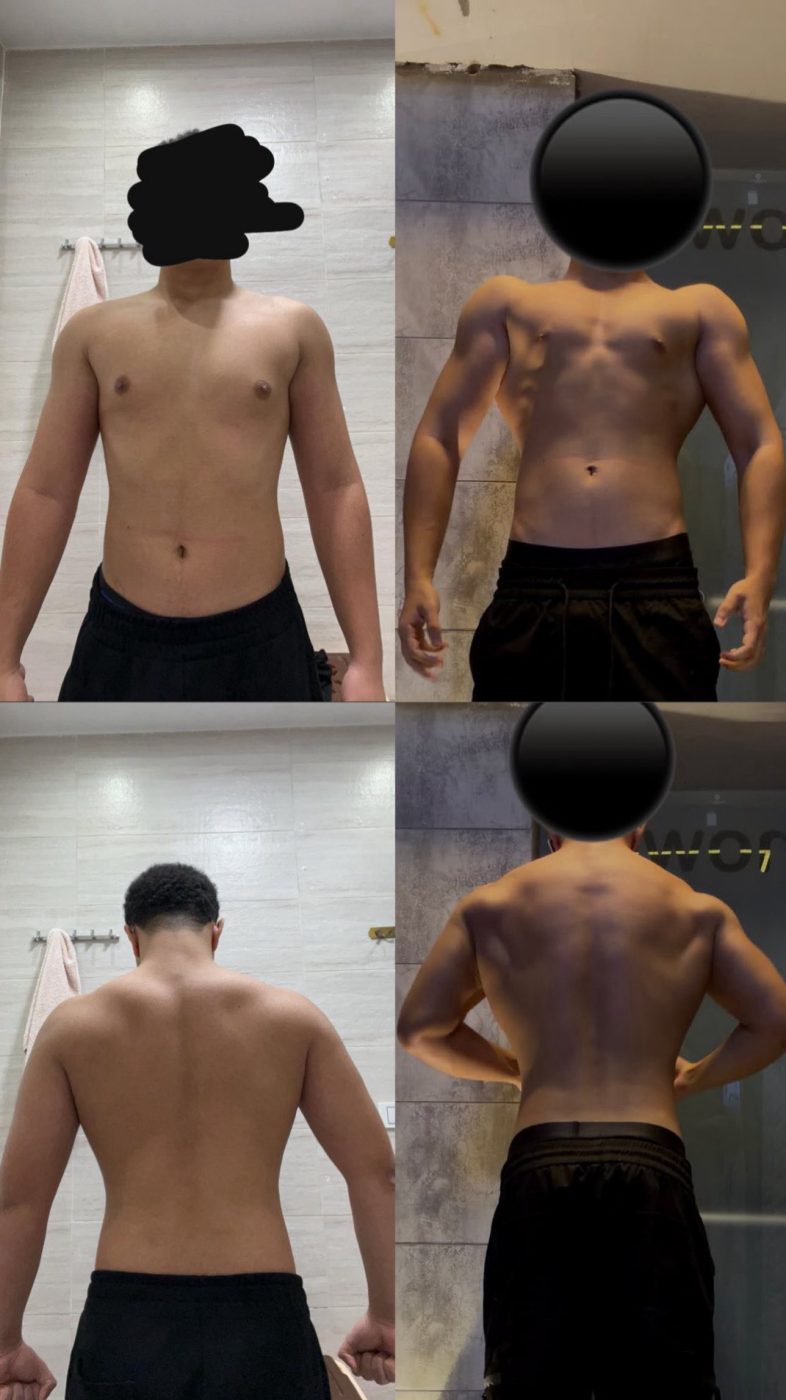 Client recomposition front and back